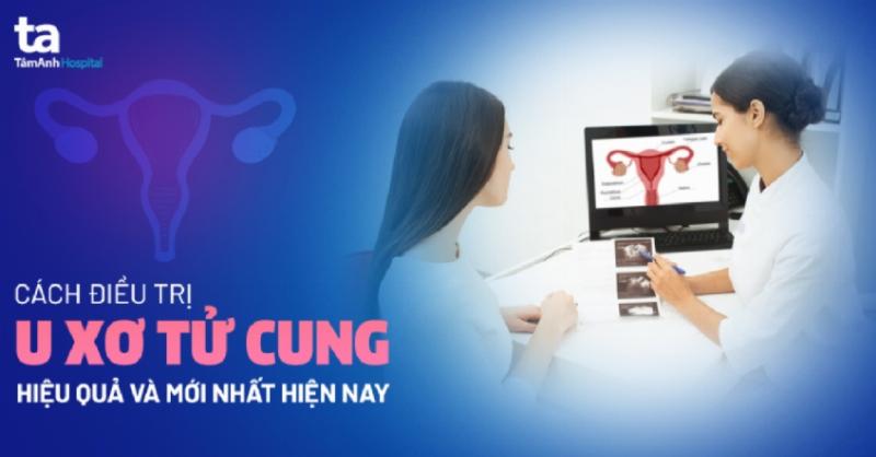 Minh họa các phương pháp phẫu thuật điều trị u xơ tử cung