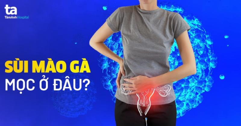 Sùi Mào Gà Giai Đoạn Đầu Có Ngứa Không? Giải Đáp Từ Chuyên Gia