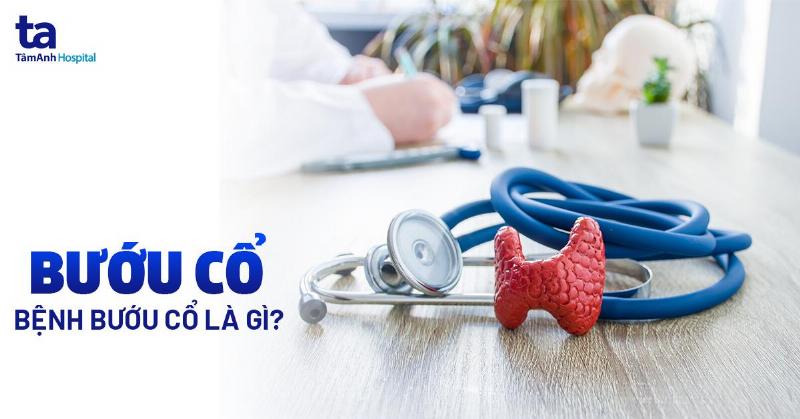 Biểu Hiện Của Bướu Cổ: Dấu Hiệu Nào Cho Thấy Tuyến Giáp Đang Báo Động?