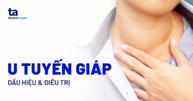 Cách Nhận Biết Ung Thư Tuyến Giáp Sớm Nhất: Dấu Hiệu Quan Trọng Không Thể Bỏ Qua