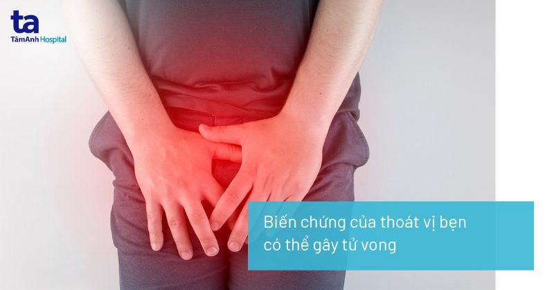 Minh họa các hoạt động giúp phòng ngừa thoát vị bẹn như nâng vật đúng cách, ăn nhiều chất xơ, tập thể dục