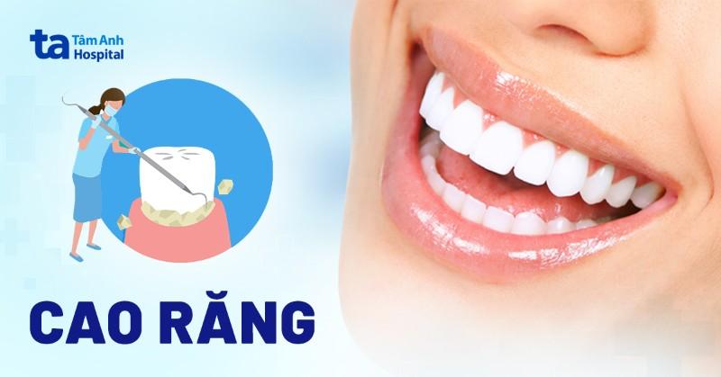 Cạo Vôi Răng Có Đau Không? Sự Thật Từ Chuyên Gia Nha Khoa Bảo Anh