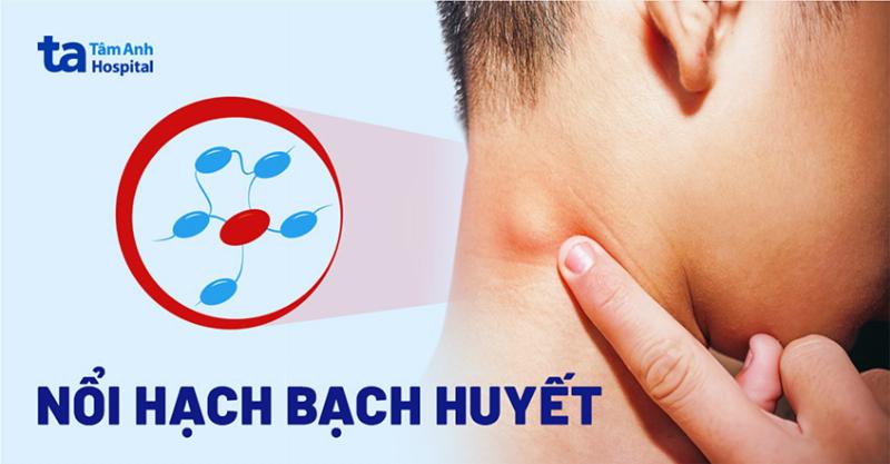 Một hình ảnh minh họa các bước chăm sóc bản thân và khi nào cần đi khám khi phát hiện nổi hạch ở háng.