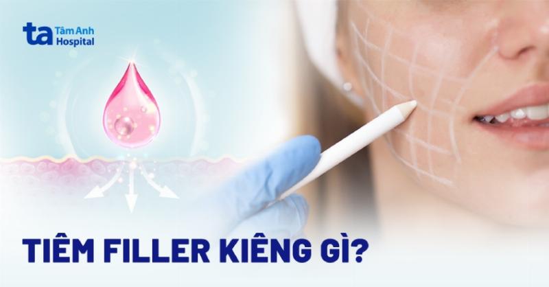 Tiêm tan Filler Bao Lâu Thì Hết Sưng?
