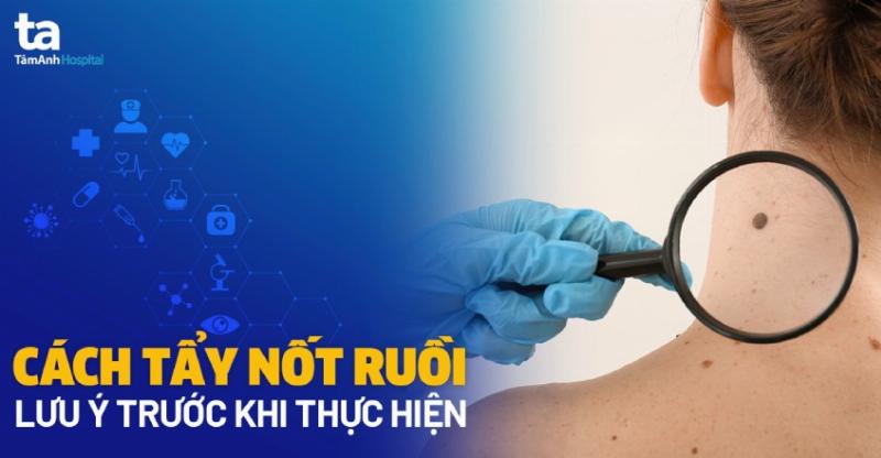 Hình ảnh minh họa các bước chăm sóc da sau khi xóa nốt ruồi trên mặt nam giới