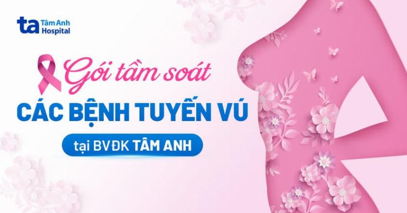 Minh họa người phụ nữ đang thực hiện tự khám vú hoặc đi khám vú định kỳ
