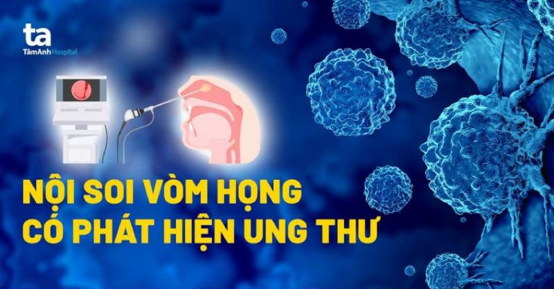 Polyp Mũi Có Nguy Hiểm Không? Chuyên Gia Giải Đáp Tận Tình
