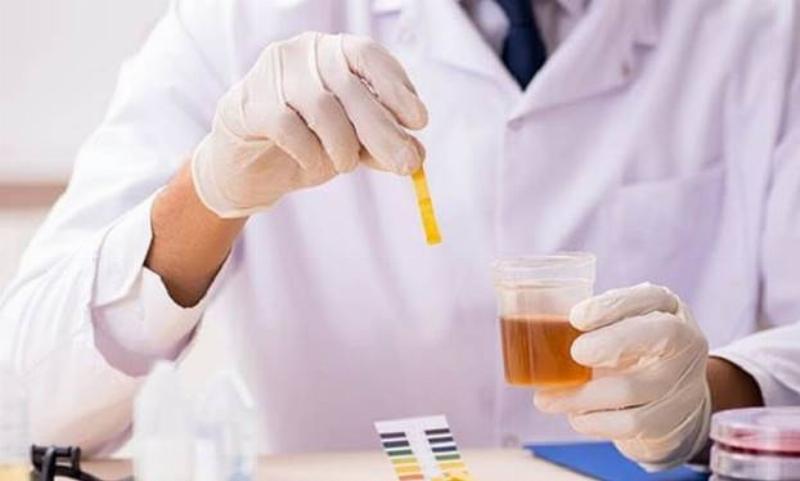 Suy thận độ 1 sống được bao lâu? Tiên lượng và cách quản lý hiệu quả