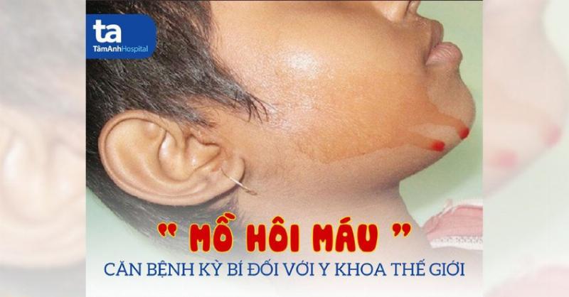 Hình ảnh mô tả khái quát chảy máu cam và vị trí mạch máu trong mũi