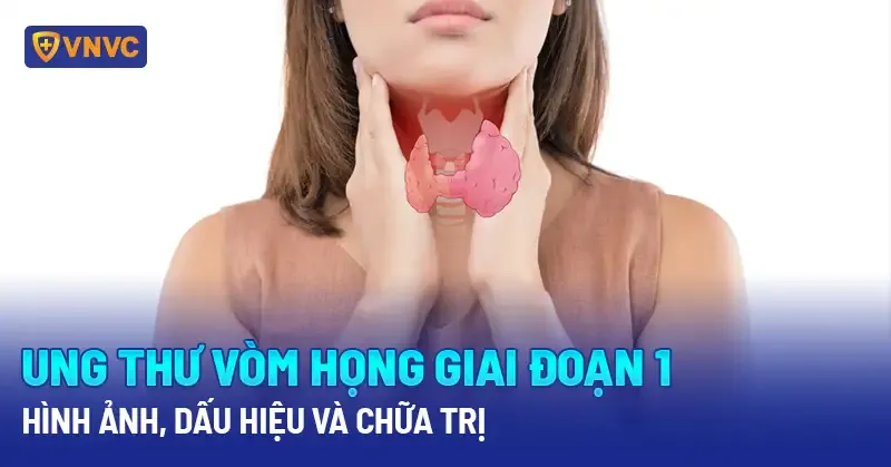 Chảy máu cam và hơi thở có mùi hôi - dấu hiệu ung thư vòm họng