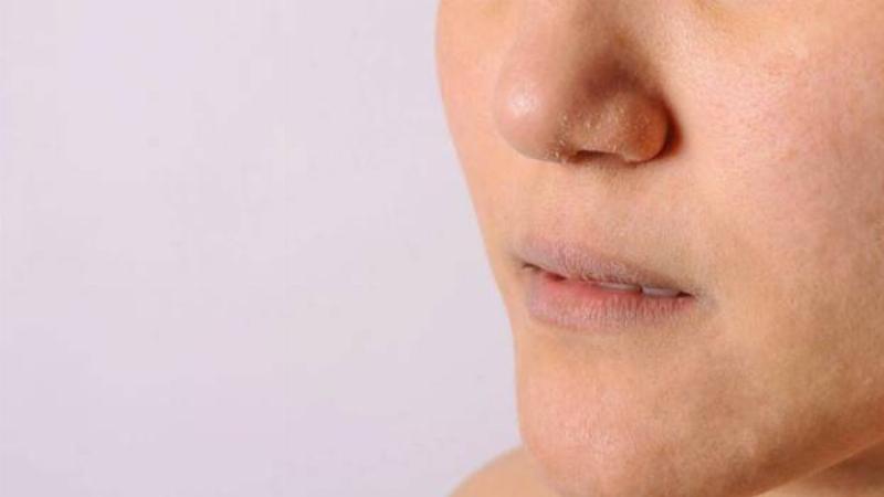 Lựa chọn thực phẩm tốt cho da khi bị ngứa và sần sùi, tăng cường sức khỏe làn da từ bên trong