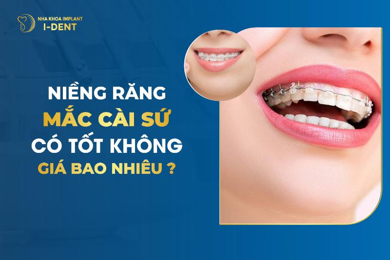 Chi phi nieng rang mac cai su cho rang ho