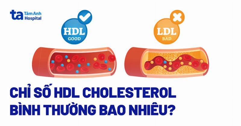 Hình ảnh minh họa chỉ số HDL cholesterol thấp và ý nghĩa đối với sức khỏe tim mạch