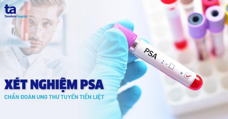 Minh họa các bước chuẩn bị cho xét nghiệm định lượng PSA toàn phần