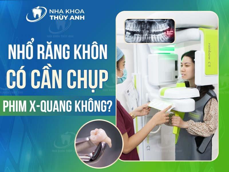 Hình ảnh chụp X-quang răng trước khi nhổ