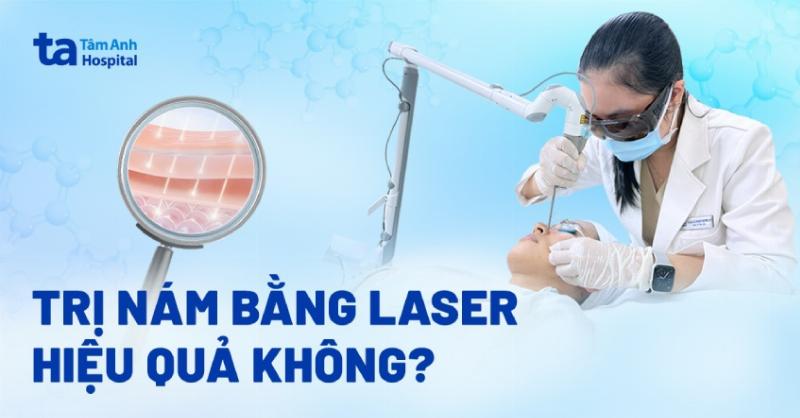 Chuyên gia da liễu giả định đang tư vấn về việc sử dụng kem tái tạo da sau khi bắn laser.