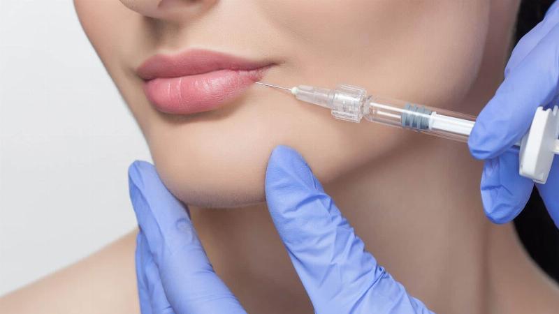 Dấu Hiệu Tiêm Filler Môi Bị Hoại Tử: Nhận Biết Sớm Để Tránh Hậu Quả Khôn Lường