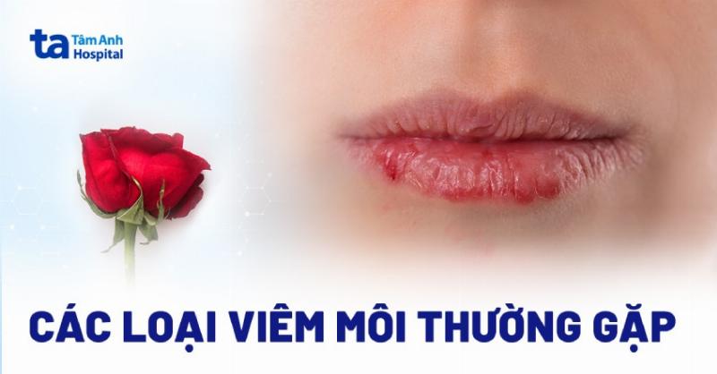 Khi nào cần đi khám bác sĩ vì bị lở miệng ở môi