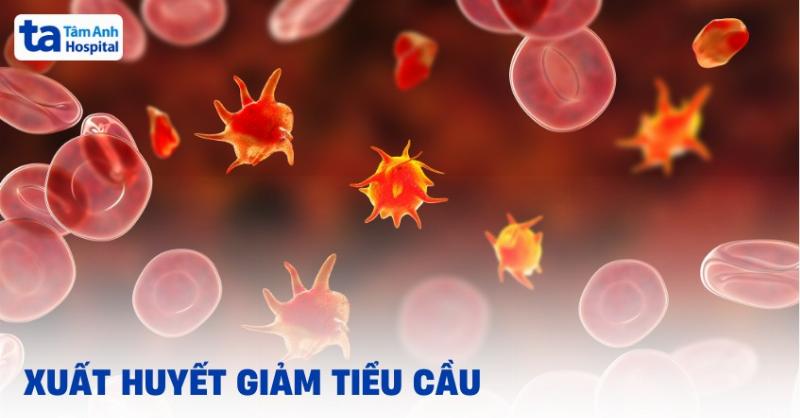 Giảm tiểu cầu ở trẻ em có nguy hiểm không? Chuyên gia giải đáp