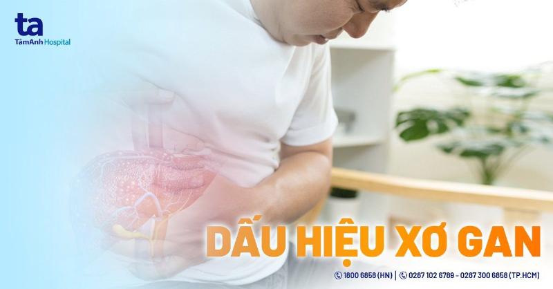 Ung Thư Gan Giai Đoạn Đầu Sống Được Bao Lâu? Phân Tích Từ Góc Độ Sức Khỏe Toàn Diện