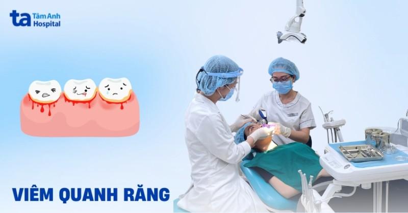 Bị Sưng Nuou Rang Răng: Nguyên Nhân, Triệu Chứng Và Giải Pháp Hiệu Quả