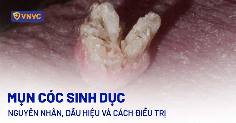 Hình ảnh minh họa quá trình thăm khám tại phòng khám chuyên khoa Nam học để kiểm tra thân dương vật nổi mụn trắng.
