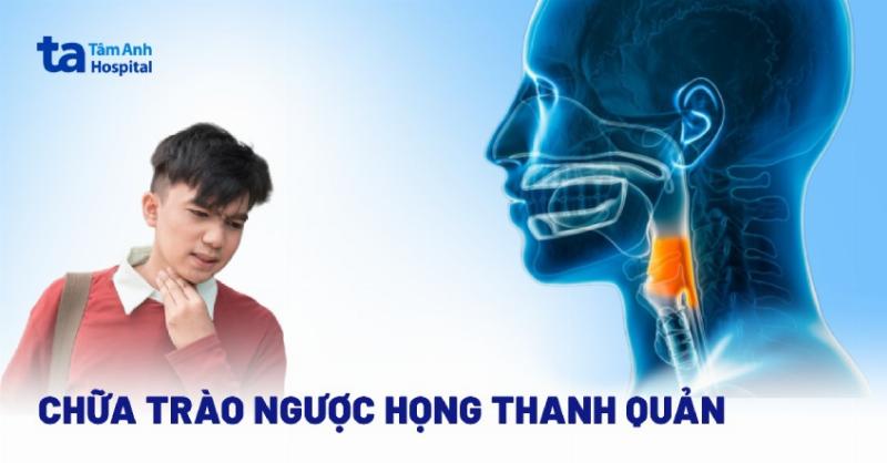 Hình ảnh minh họa Gaviscon như một giải pháp tạm thời, không phải chữa khỏi hoàn toàn bệnh trào ngược
