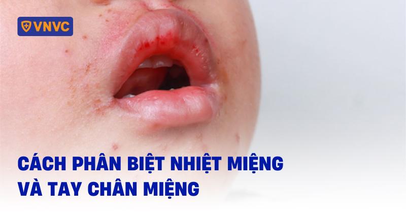 Hình ảnh minh họa hệ miễn dịch gây nhiệt miệng