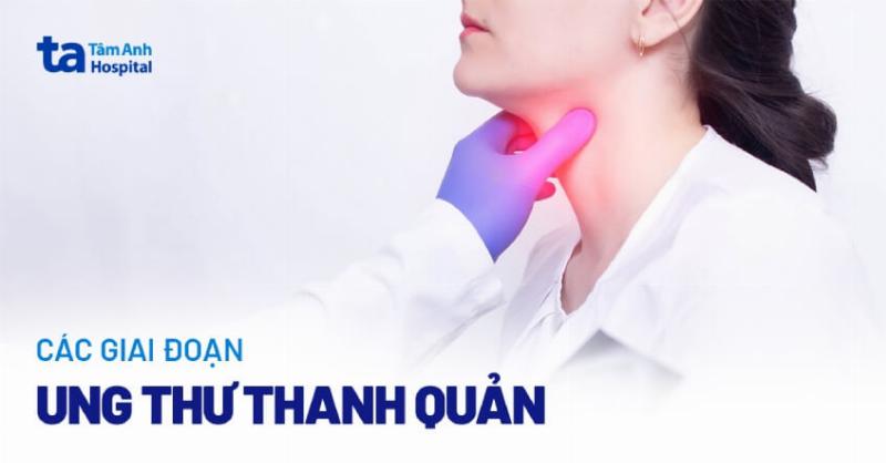 Hình ảnh ung thư lưỡi giai đoạn 2: Nhận Biết Sớm Dấu Hiệu Quan Trọng