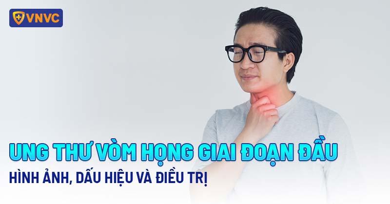 Ung thư vòm họng chữa được không? Điều bạn cần biết từ A-Z