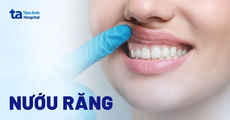 Hình ảnh minh họa mối liên hệ giữa sức khỏe tim mạch (biểu tượng trái tim) và sức khỏe răng miệng (biểu tượng răng/nướu) bằng các đường kết nối