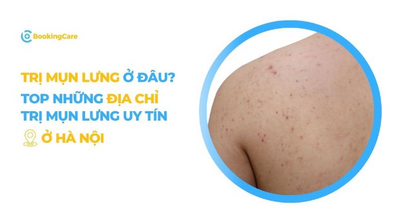 Hinh anh truoc va sau khi dieu tri mun lung cho thay su cai thien ro ret