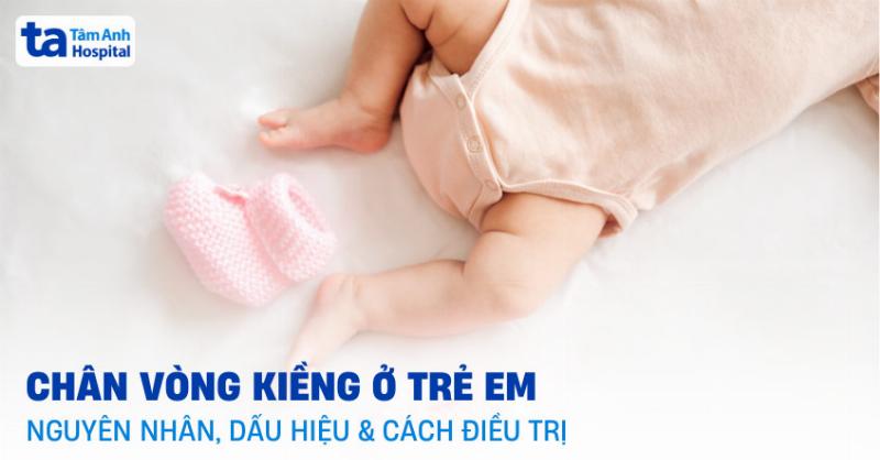 Chân Vòng Kiềng Có Khắc Phục Được Không? Giải Đáp Chi Tiết Từ Chuyên Gia