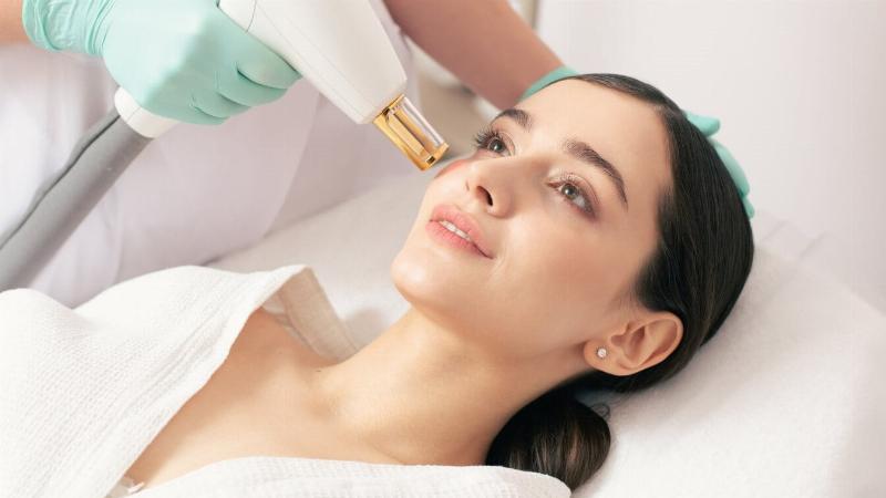 Khuôn Mặt Sau Khi Bắn Laser: Hành Trình Lột Xác Hay Những Điều Cần Biết?