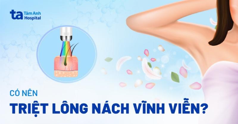 Hình ảnh minh họa máy triệt lông nách bằng công nghệ laser hoặc IPL đang hoạt động trên vùng nách giả định.