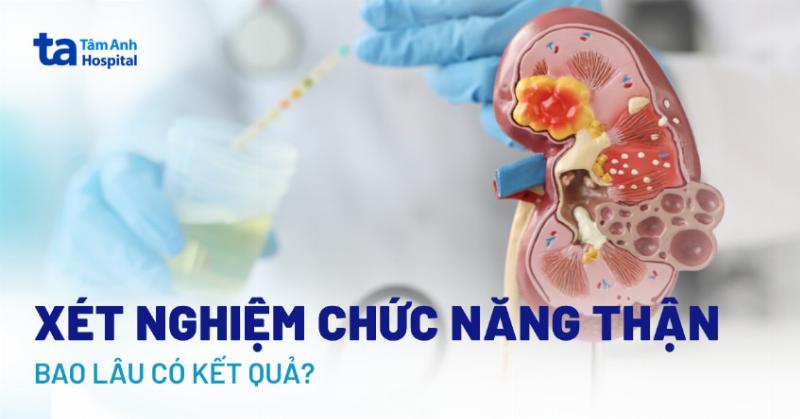 Xét Nghiệm Gì Để Biết Suy Thận Chính Xác Và Nhanh Nhất?