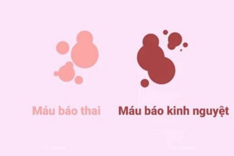 Máu Báo Thai Có Màu Gì? Dấu Hiệu Quan Trọng Bạn Cần Biết Sớm
