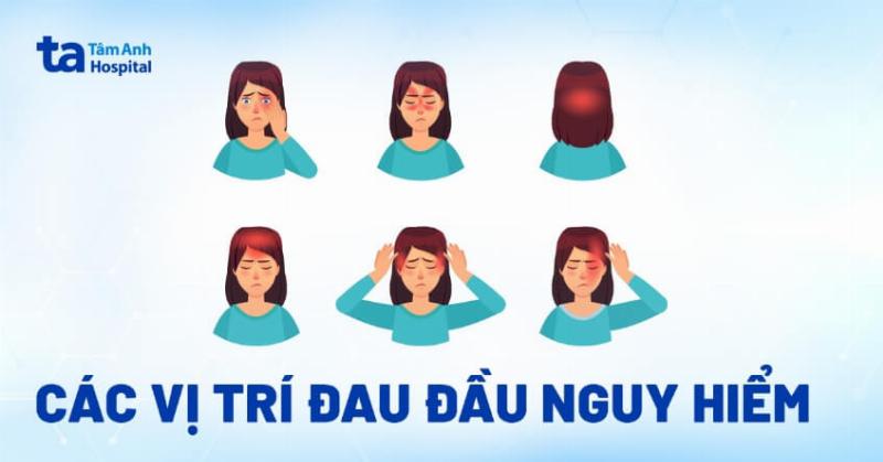 Cách Giảm Đau Đầu Sau Gáy Tại Nhà Hiệu Quả và An Toàn