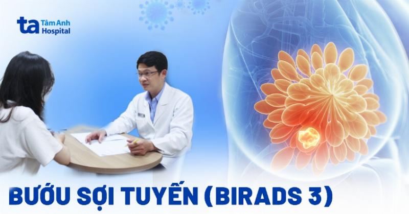 Hình ảnh mô tả sự tăng sinh của mô sợi tạo thành cấu trúc giả bướu trong bệnh lý