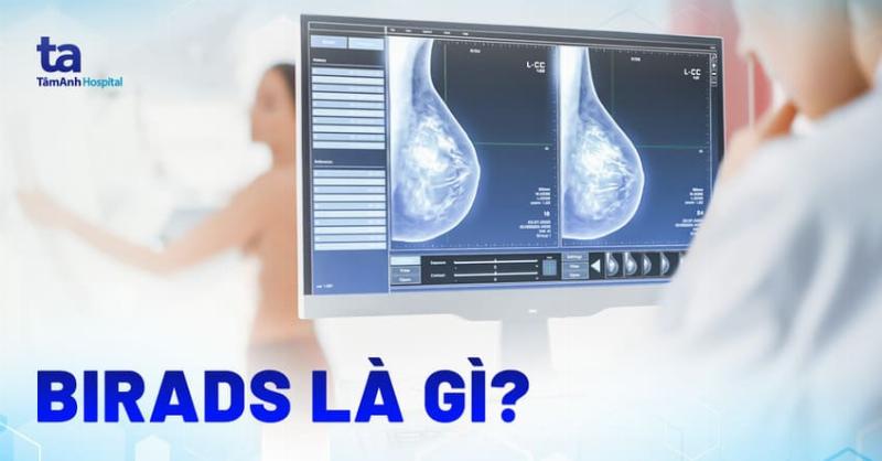 Hình ảnh minh họa các loại mật độ mô vú trên phim nhũ ảnh (từ mô mỡ đến rất dày), giải thích tại sao mô dày khó đọc hơn, liên quan đến tầm soát ung thư vú ở đâu tốt nhất tphcm