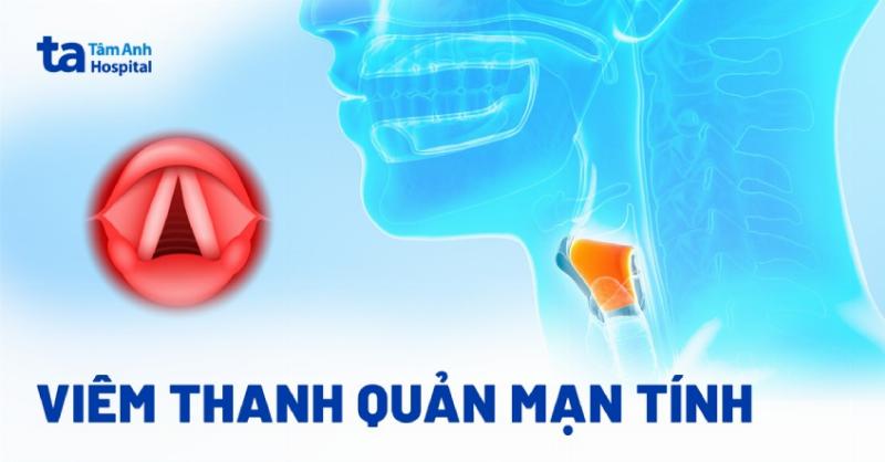 Dấu hiệu viêm thanh quản: Nhận biết sớm để bảo vệ giọng nói và sức khỏe