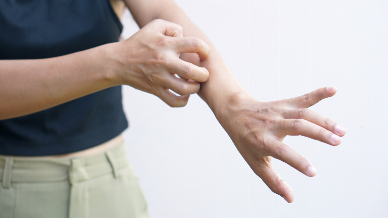 Hiểu Rõ Các Loại Thuốc Trị Ngứa: Hướng Dẫn Chi Tiết Từ Chuyên Gia