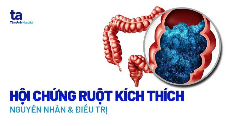 Đau Bụng Không Rõ Nguyên Nhân: Hiểu Rõ Dấu Hiệu & Cách Xử Lý