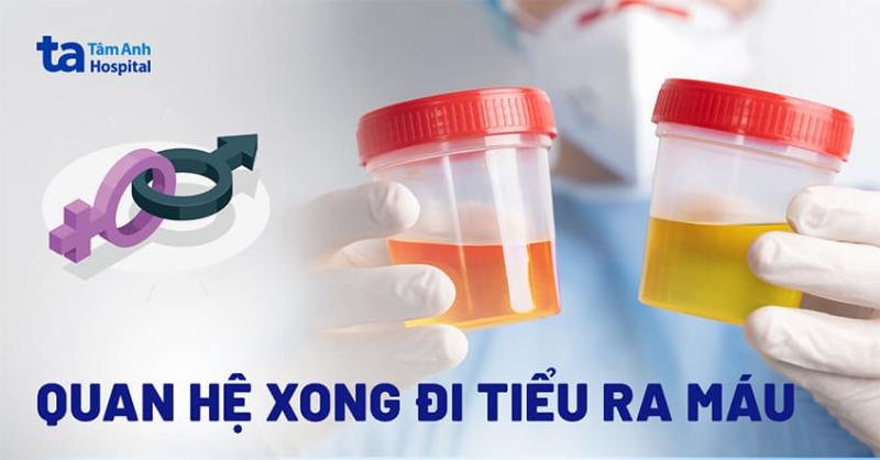 Tiểu Ra Máu Sau Quan Hệ 2 Ngày: Nguyên Nhân, Dấu Hiệu Và Lời Khuyên Chuyên Gia