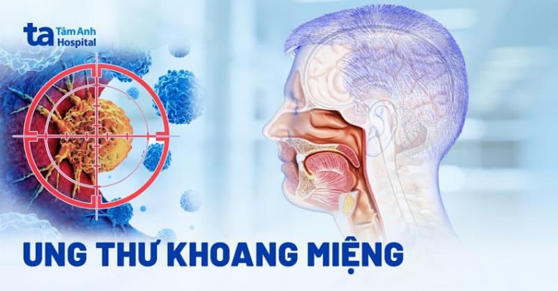 Ung Thư Niêm Mạc Má: Dấu Hiệu, Chẩn Đoán Và Cách Phòng Ngừa Hiệu Quả
