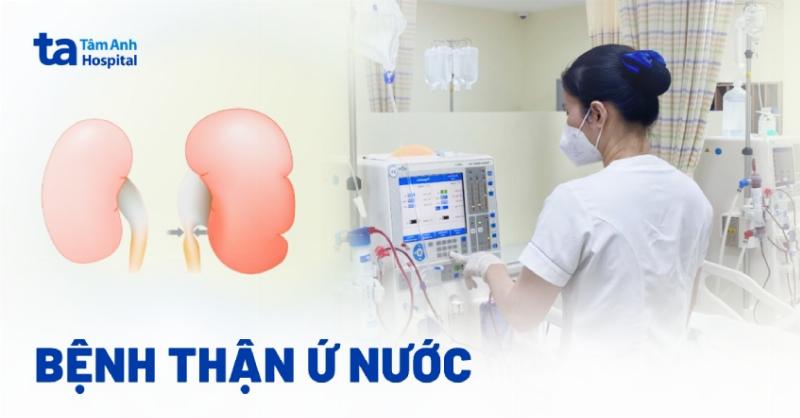 Luu y quan trong khi ap dung cach ho tro tri thuan u nuoc do 1 tai nha duoi su huong dan cua bac si