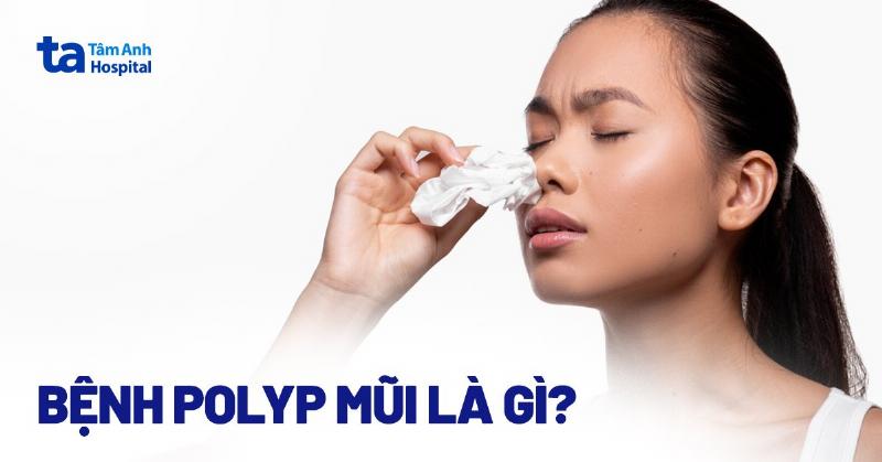 Hình ảnh minh họa niêm mạc mũi bị sưng phù do viêm nhiễm gây nghẹt mũi khó thở
