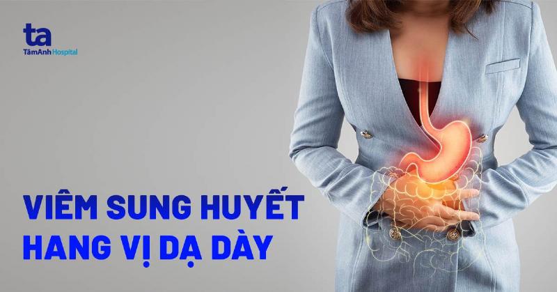 Viêm Xung Huyết Hang Vị Điều Trị Bao Lâu? Giải Đáp Từ Chuyên Gia