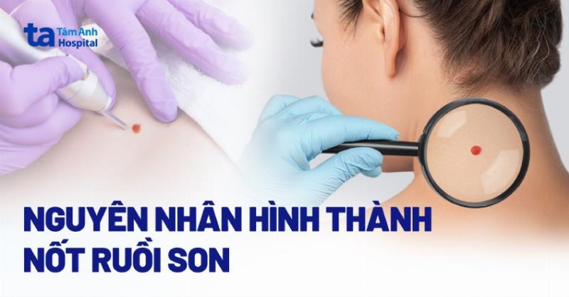 Hình ảnh minh họa sự kết hợp giữa khoa học và quan niệm về nốt ruồi trên mặt nam giới