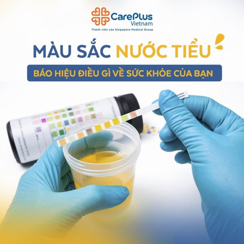 Hình ảnh minh họa nước tiểu màu vàng đục ở nữ do tình trạng cơ thể thiếu nước